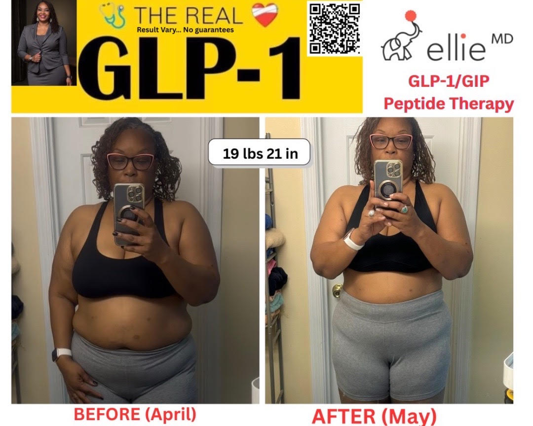 glp-1 psoriasis The Dermatologist | 🔥 GLP-1s aren't just for diabetes anymore. Now being  explored for: ✨ Psoriasis ✨ HS ✨ Eczema (AD) With 6% of Americans using  them, GLP-1